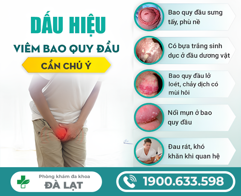 Hình ảnh minh họa